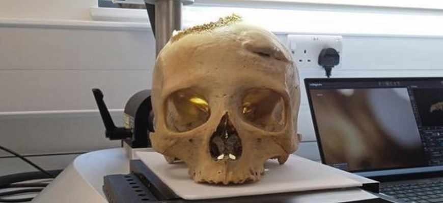 удалить, опухоль,